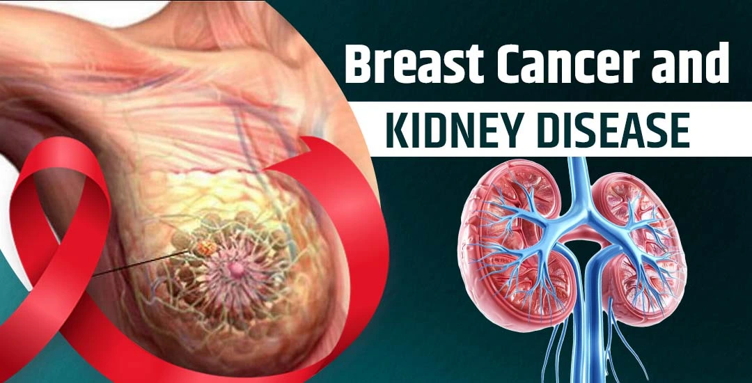 Can Breast Cancer Affect Kidney Function?